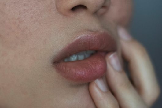A woman with freckles and her hand on her lips.